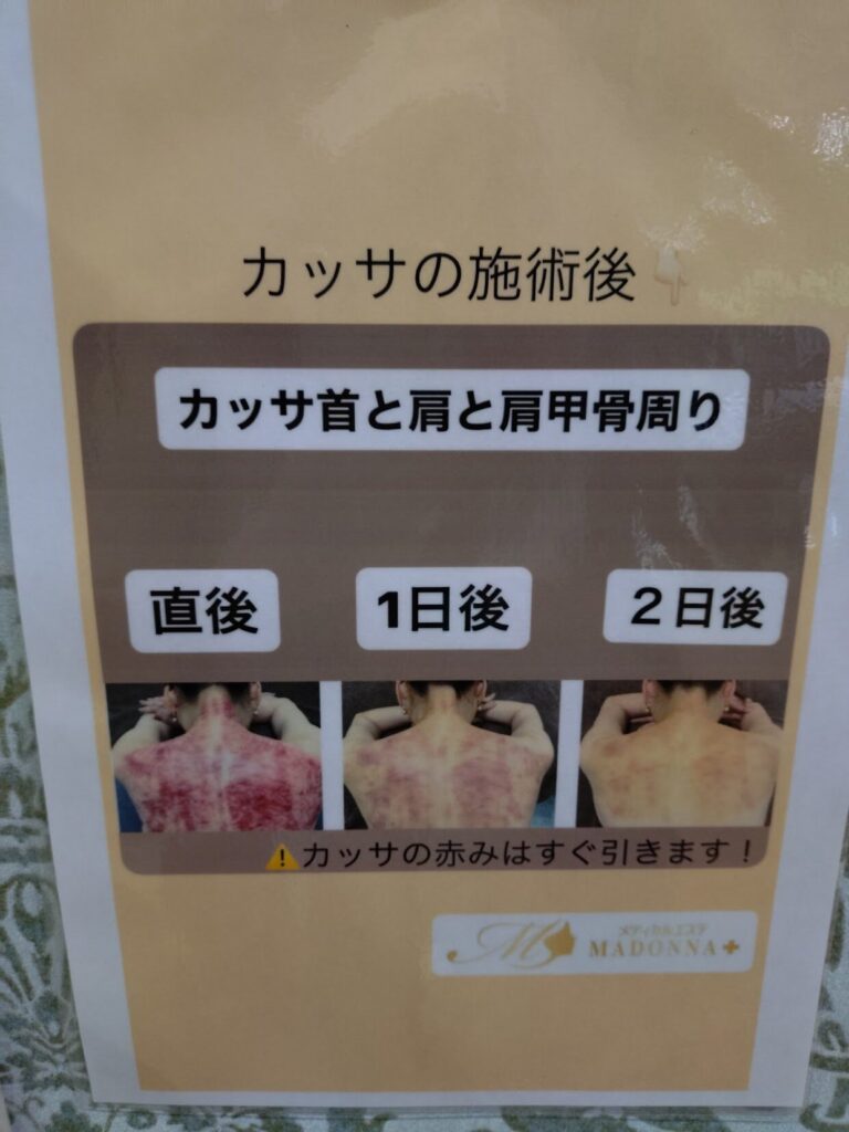 メディカルマドンナ,富士宮店,マドンナ,カッサ,マッサージ,駐車場,どこ,場所,メニュー,定休日,子ども連れ,営業時間,体験,レビュー