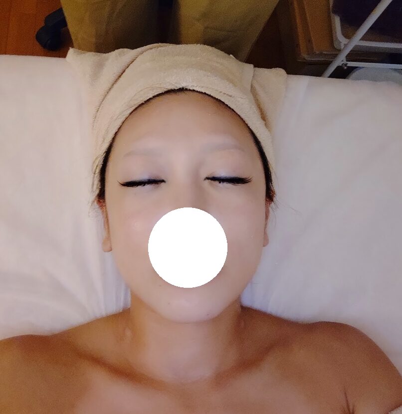 TreeMi,ツリーミー,脳洗浄,核酸,フェイシャル,フォーデイズ,静岡,核酸DNA,子ども連れ,場所,定休日,駐車場,レビュー,体験