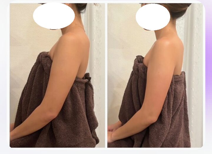 二の腕,痩せ,清水,静岡,ダイエット,ミント,二の腕デザイン,Mint,痩身,よもぎ蒸し,パーソナルカラー,痩身サロン,定休日,営業時間,駐車場,効果,レビュー