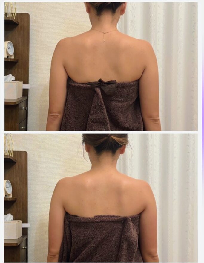 二の腕,痩せ,清水,静岡,ダイエット,ミント,二の腕デザイン,Mint,痩身,よもぎ蒸し,パーソナルカラー,痩身サロン,定休日,営業時間,駐車場,効果,レビュー