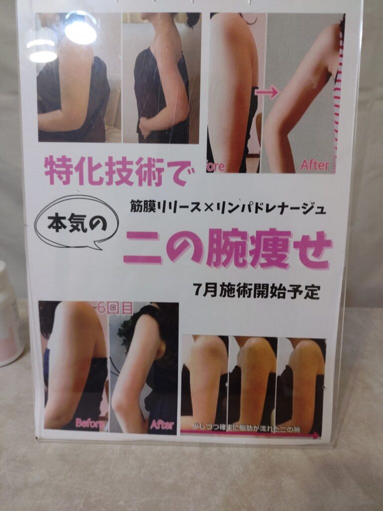 二の腕,痩せ,清水,静岡,ダイエット,ミント,二の腕デザイン,Mint,痩身,よもぎ蒸し,パーソナルカラー,痩身サロン,定休日,営業時間,駐車場,効果,レビュー,筋膜リリース,リンパ