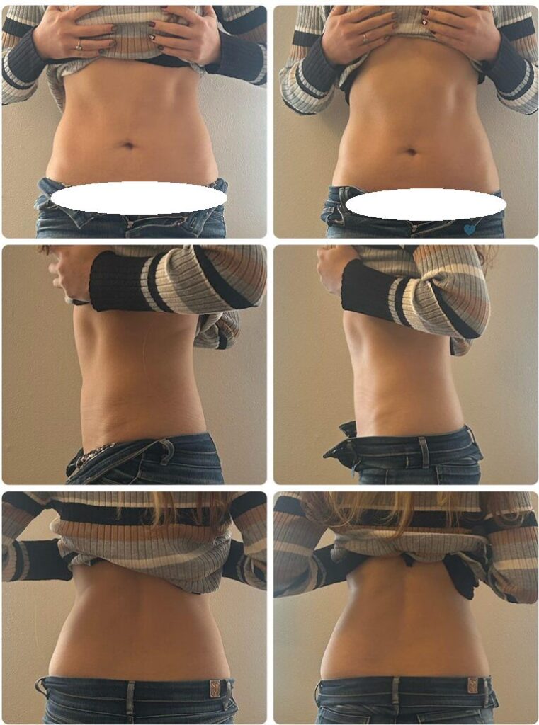 腸活サロンMEGURIA,静岡,腸活,妊活,腸揉み,腸もみ,よもぎ蒸し,駿河区,MEGURIA,場所,定休日,予約,李行時間,子ども連れ,駐車場,妊娠,宿便,便秘、下痢,くびれ,痩身,ダイエット,レビュー,体験,腸マッサージ